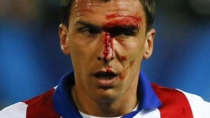 Mandzukic